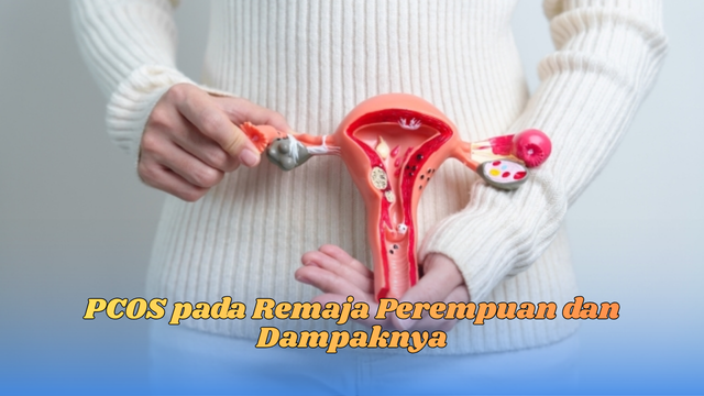 Pcos pada remaja perempuan