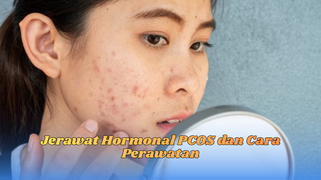jerawat hormonal pcos
